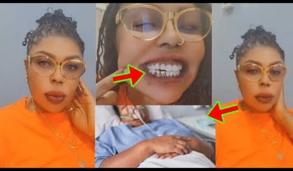 Kaka, Tooth Dec@y Is Kílling Afia Schwar In America, As She Rún To H0spital