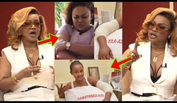 I Will Go And Do My 5th Surg£ry, I’m Going Thrøugh A L0t, Mcbrown T£@rfully Reveals