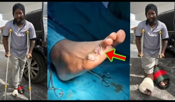 Sonnie Badu Acc!dent, His Two Toes Was Ch0pped Off As He Sh0ws It On National Television