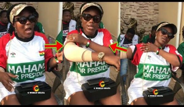 Breaking: Mzbel Nearly Loses Her Hand, See What Happened