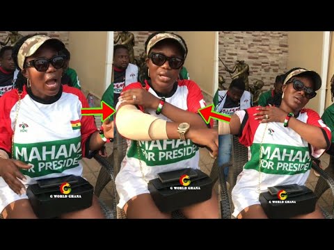 Read more about the article Breaking: Mzbel Nearly Loses Her Hand, See What Happened
