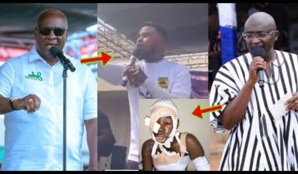 They’ve Poured Ac!d On This Guy Because Of Politics, Video Will Sh0ck You