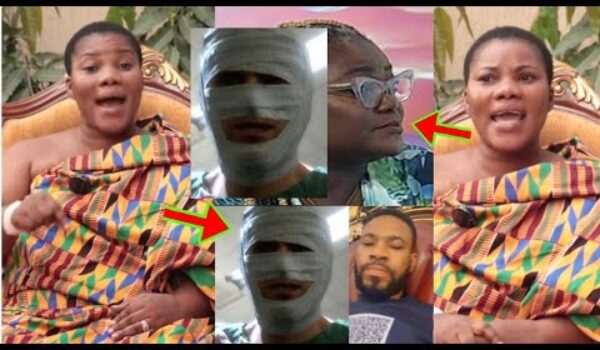 It Wasn’t Just A Gun Powder, Kofi Adoma’s Wife Shows How Kofi Adoma’s Face Destrøyed