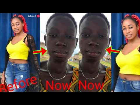 Read more about the article Sad Story Of Ghanaian Lady Who Is Dying After Returning Back From Saudi Arabia