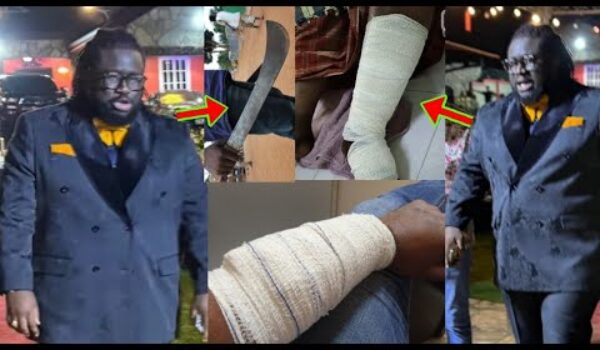 Ajagurajah Awu oo, See How They’ve Dam@ged Him