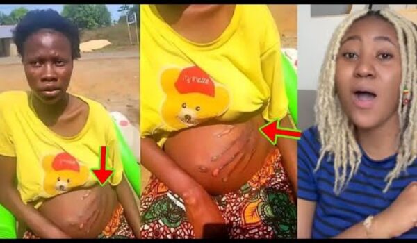 A Pr£gnant Woman Reveals A Bl00dy Handprint On Her Belly,Says She Was Sl@pped By A Spirit In A Dream