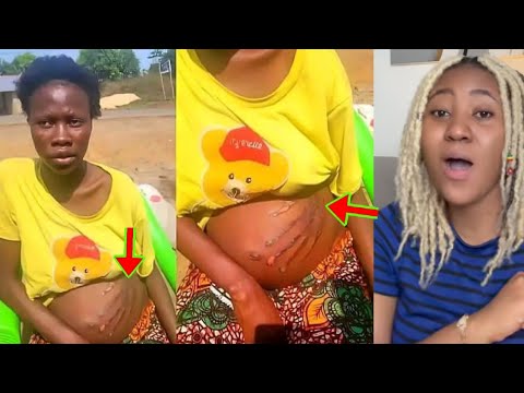 Read more about the article A Pr£gnant Woman Reveals A Bl00dy Handprint On Her Belly,Says She Was Sl@pped By A Spirit In A Dream