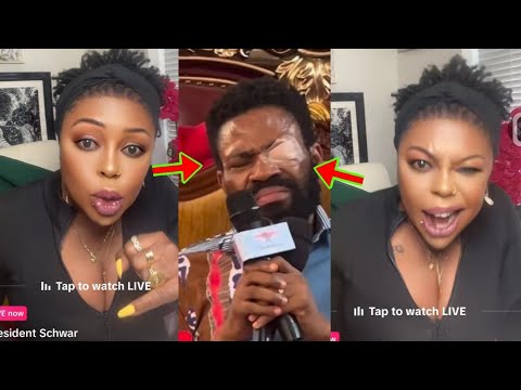 Read more about the article The Plaster Is Fake, Afia Schwar Fires And Exposes Kofi TV As She Reveals Why The Plaster Is Fake