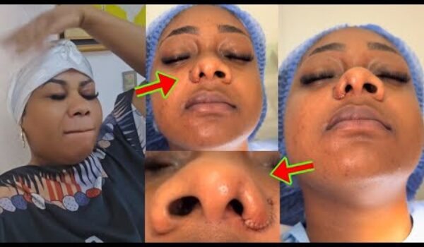 Empress Gifty Ɛbrɛ o, Check What Has Happened To Her Nose Because Of Pl@stic Surg£ry