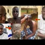 MPox Or Monkey Pox Disease Outbreak: Ghanaians Are In Fears As One Person Confirmed Déád