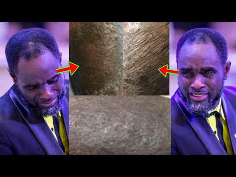 Read more about the article Ntoma Kata Ade3 so, Check The Alleged Skin Diséàse Ogyaba Is Báttling Silently