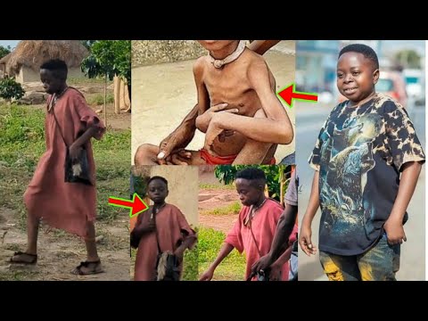 Read more about the article Check What Is Happening To Kumawood Actor Joe Shortingo’s Body, Ghanaians Reacted