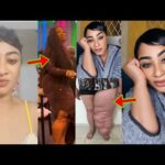 What Is Happening To Actress Ellen Kyei White’s Leg Sh0ck Ghanaians As They Reacted To It