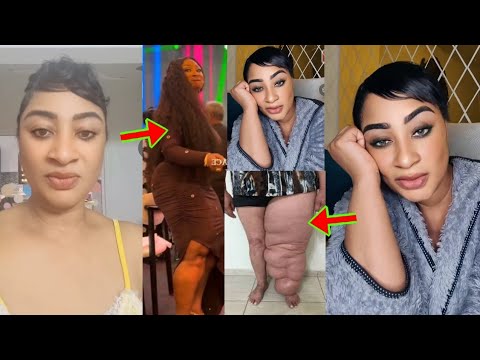 Read more about the article What Is Happening To Actress Ellen Kyei White’s Leg Sh0ck Ghanaians As They Reacted To It