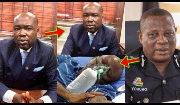 He Was Sh0t In His Chest; Akwatia MP, Ernest Kumi’s Family Reveals What They Saw At His Chest