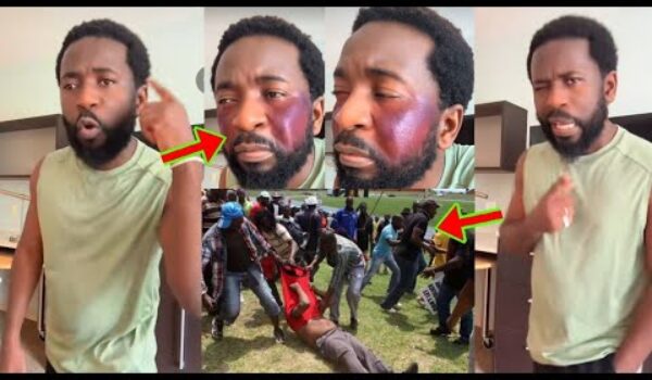 See How Musician, Bisa Kdei, Is F!ghting