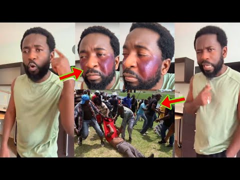 Read more about the article See How Musician, Bisa Kdei, Is F!ghting