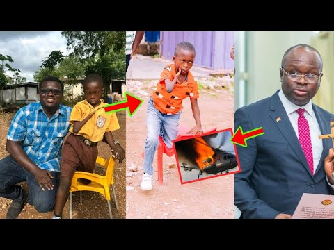 Read more about the article Dr. Omane Boamah Paid The Bill Of This Disabled Kid To Do Surgery Just 5 days Ago