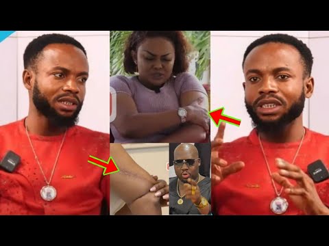 Read more about the article Mcbrown’s Arm Injúry Will K!ll Her! Mcbrown Received Bad Prophecy Over Her Hand Problem