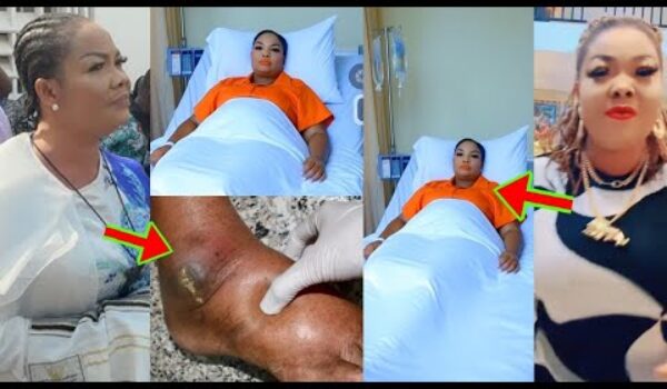 Agradaa Is Allegedly S!ck In Prison, See What Has Happened To Her Legs