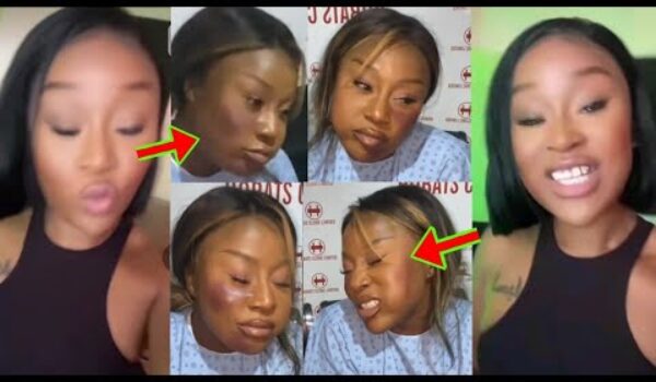 Efia Odo Sev£rely Be@ten? As Her Video Causes A Stir On The Internet