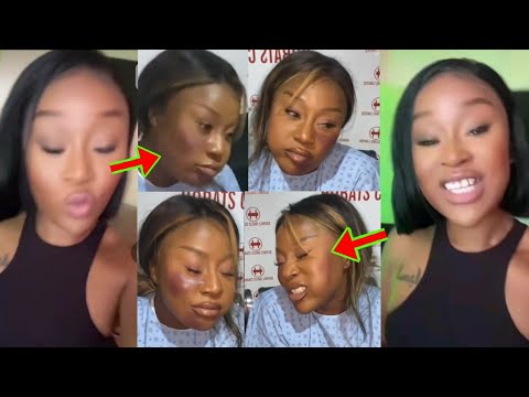 Read more about the article Efia Odo Sev£rely Be@ten? As Her Video Causes A Stir On The Internet