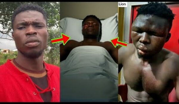 He’s Alive! Check The Current Condition Of Mustapha, The Boy Who Was Beaten For Insulting Asantehene