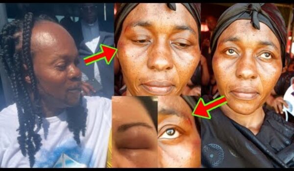 Awww, Odo Broni Received Heavy Be@tings, Video Will Sh0ck You