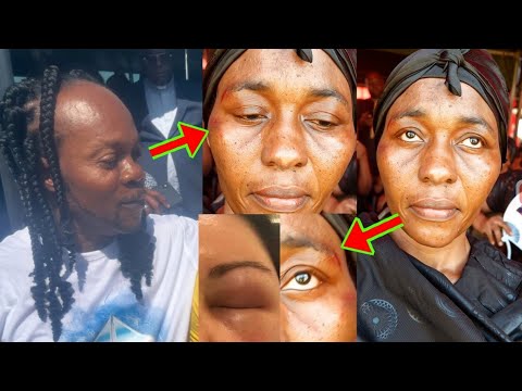 Read more about the article Awww, Odo Broni Received Heavy Be@tings, Video Will Sh0ck You