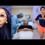 As3m aba o…, BBL Squads Have Started Removing Their BBL Implants