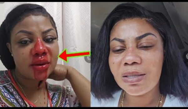 Empress Gifty Amanehunu; See What Empress Gifty Is Going Through, Very Sad