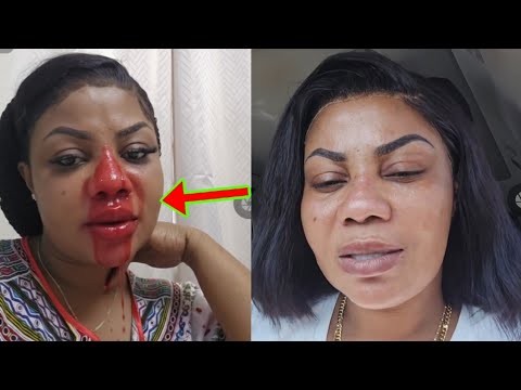 Read more about the article Empress Gifty Amanehunu; See What Empress Gifty Is Going Through, Very Sad