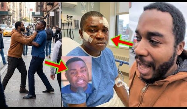 Kevin Taylor Dam@ged As Twene Jonas Finished Him In America