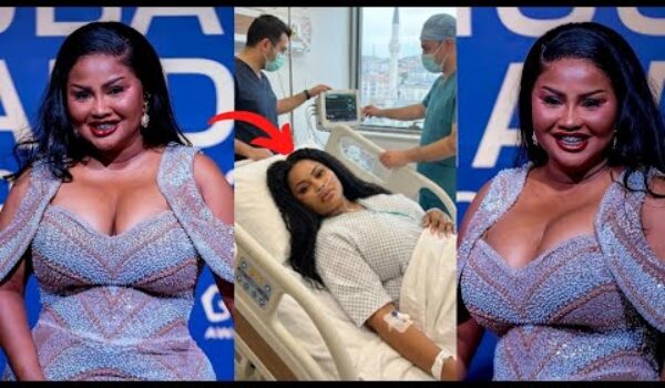 Nana Ama McBrown Undergoes Br£@st Augmentation Surg£ry