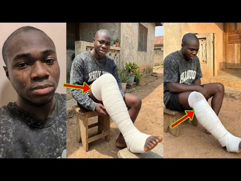 Read more about the article My Leg, I’m Dy!ng; Twene Jonas Apprentice Young Don Cries For Help