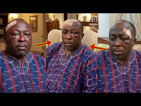 Read more about the article Odo Broni Lawyer, Baba Jamal, Attacked By Some Team Legal Wives’ Members