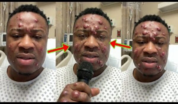 Trouble Carlos Is Shaking As He Breaks Silence On His Condition Amid His Cur$e