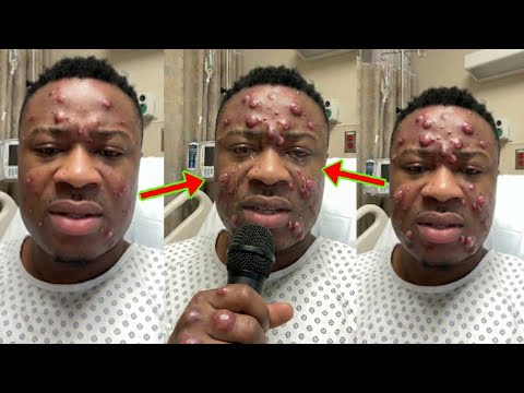 Read more about the article Trouble Carlos Is Shaking As He Breaks Silence On His Condition Amid His Cur$e