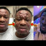 Kwame Ato’s Cur$e Starts Working Against Trouble Carlos, What’s Happening To His Face Will Sh0ck You