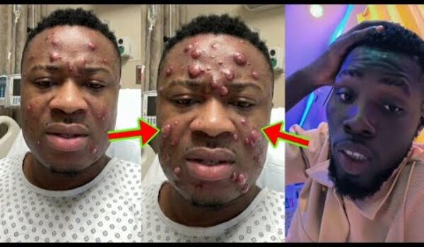 Kwame Ato’s Cur$e Starts Working Against Trouble Carlos, What’s Happening To His Face Will Sh0ck You