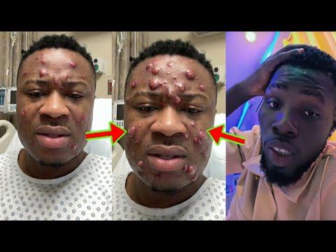 Read more about the article Kwame Ato’s Cur$e Starts Working Against Trouble Carlos, What’s Happening To His Face Will Sh0ck You