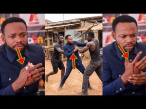 Prophet Roja Attcked With Sh0vel As They Injurd His Hand 300x225